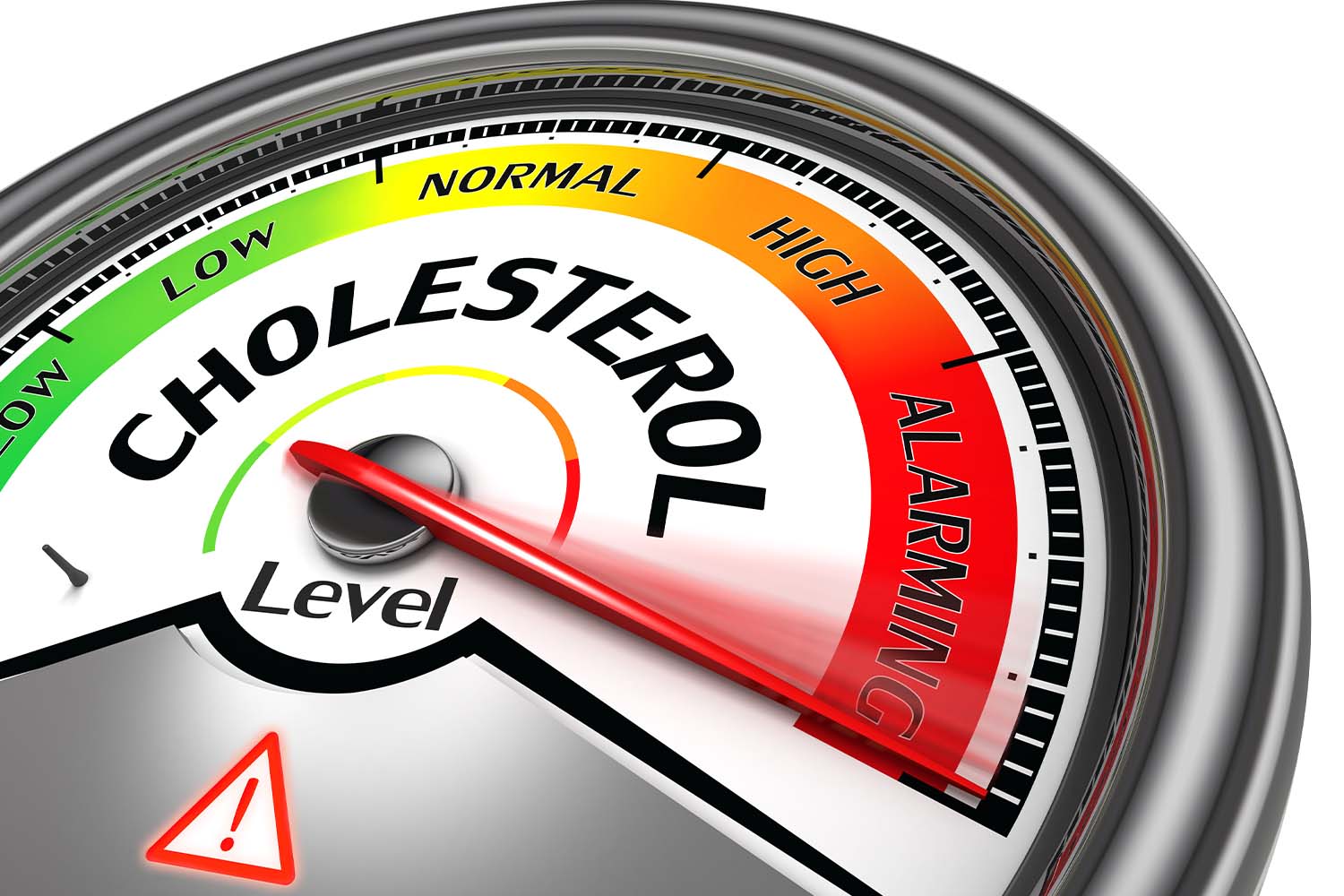 Cholesterol gauge showing alarming high levels.